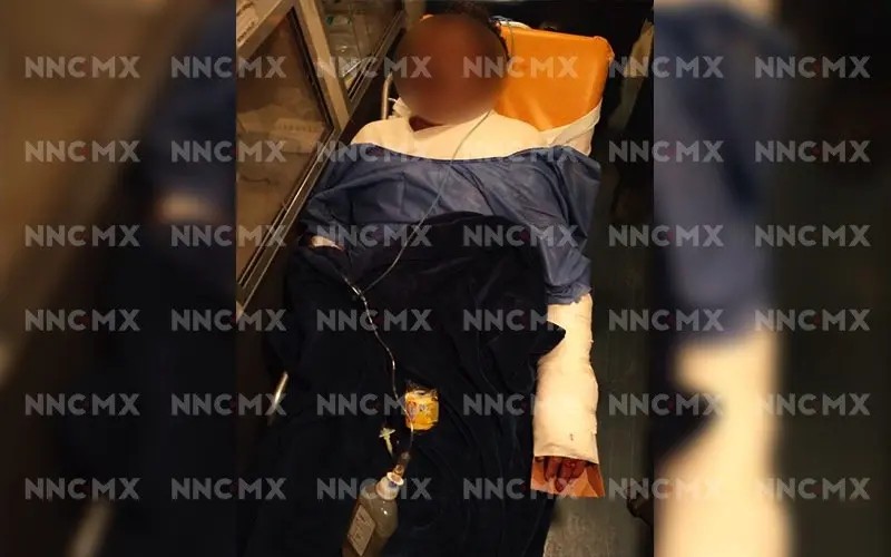 Cocodrilo atacó a un pescador