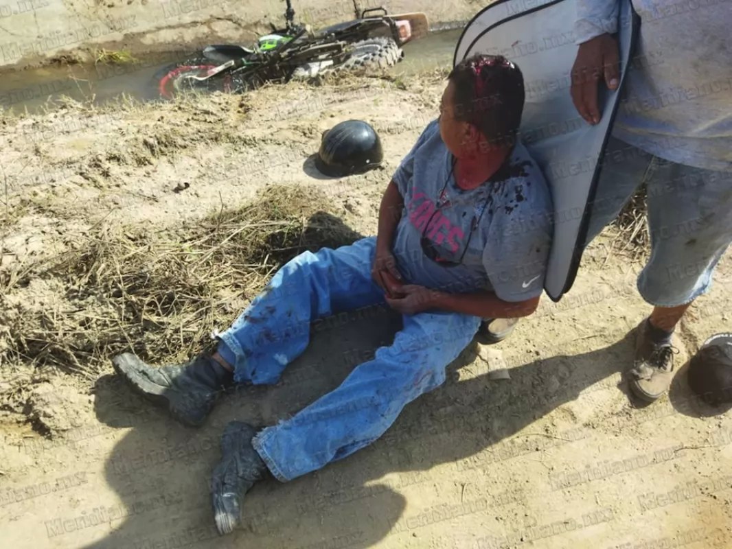 ¡sangriento encontronazo!