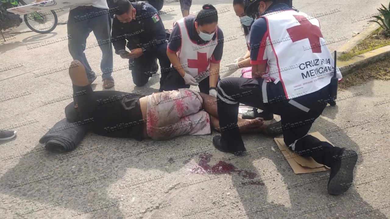 ¡motociclista resulta con terrible fractura!