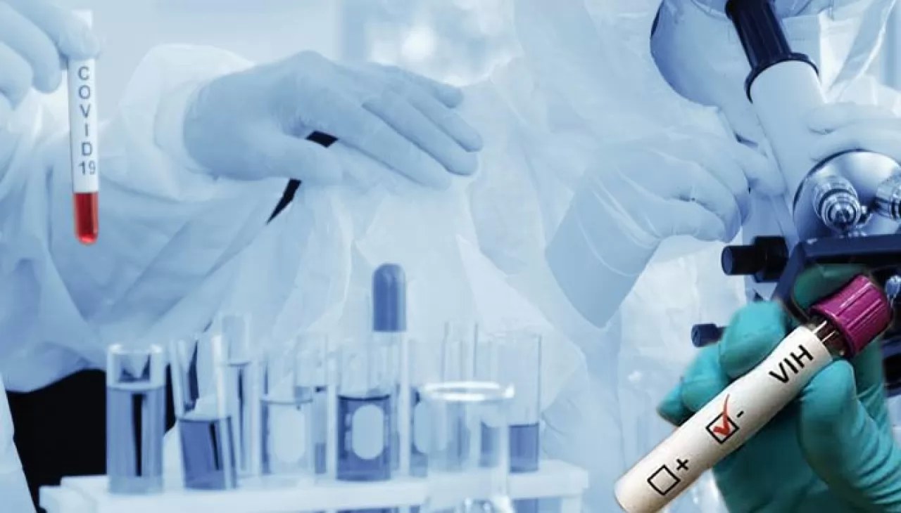 Urgen actualizar cifras de contagios de VIH en Nayarit