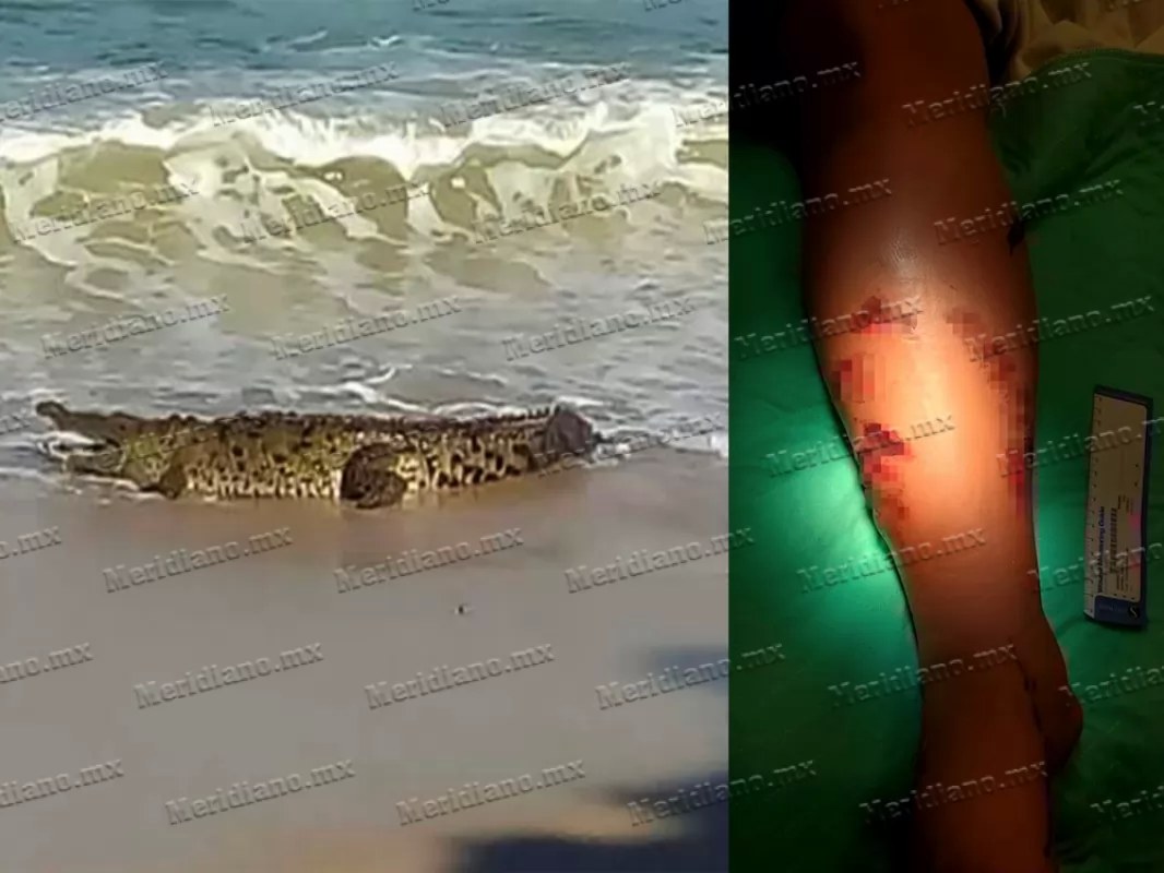 ¡turista fue atacada por cocodrilo!