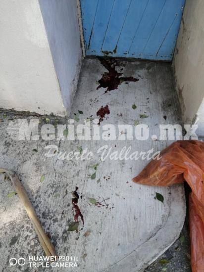 En la colonia independencia… ¡un perro bravo atacó a ancianito!