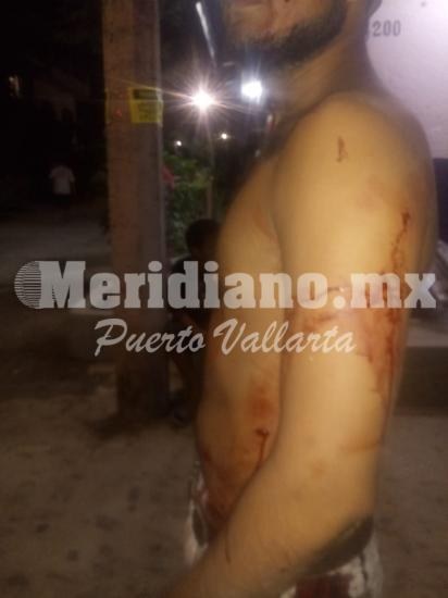 En la guadalupe victoria…  ¡navajeado en una riña!