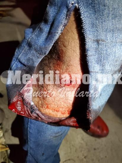 En colonia las canoas…  ¡chocaron motociclistas!