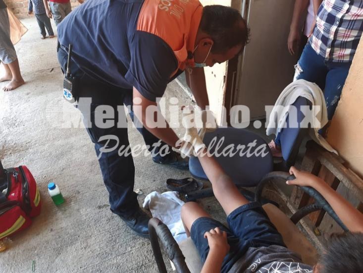 Es vecinito de ixtapa…  ¡niño se enterro varilla oxidada!