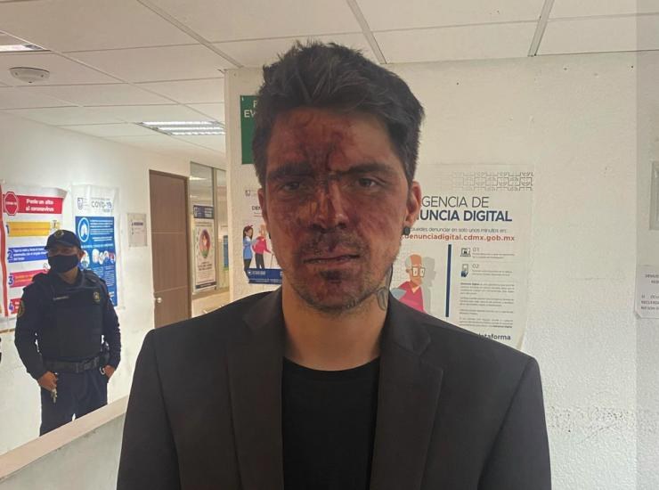 \"Temo por mi vida\": Hijo de Lupita D`Alessio acusa a ex Gobernador de propinarle golpiza