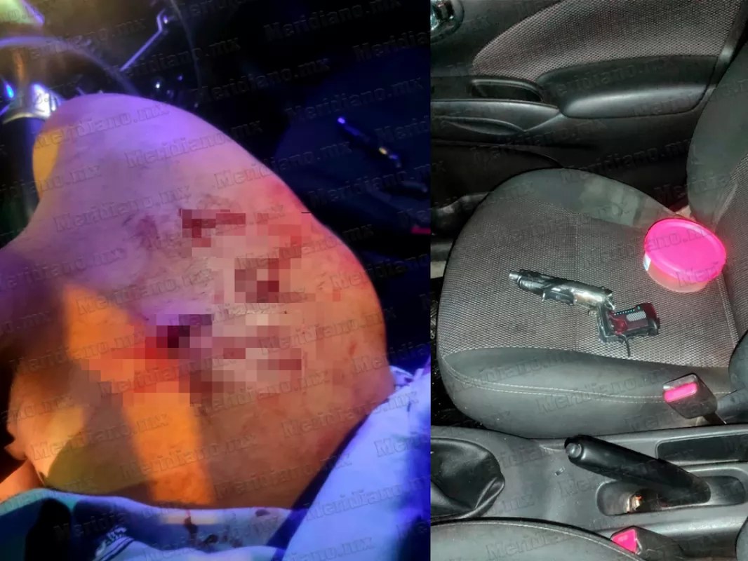 ¡Sangriento asalto en Los Fresnos!: Hieren a chofer de plataforma