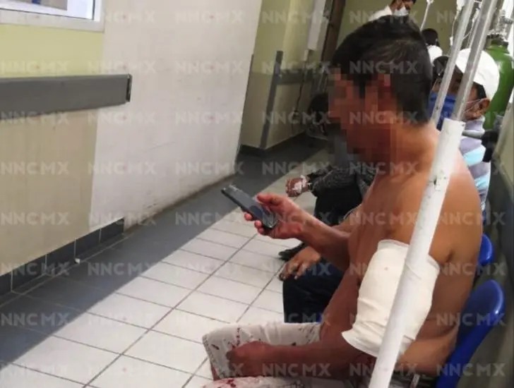 Puerto Vallarta. Acuchillado durante riña en la Palmar del Progreso